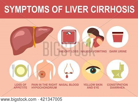 Liver Cirrhosis Symptom With Useful Advices Infographic In Flat Design. Health Care Concept.