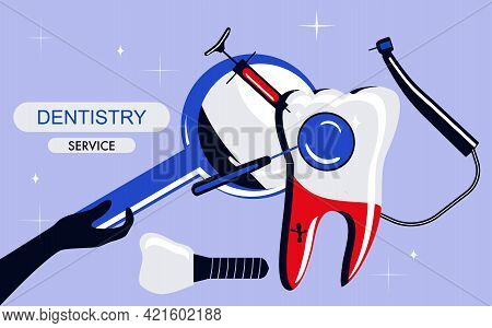 Dentistry Service Banner In Pop Art Style.huge Molar And Implant.drill Bit, Curing Teeth With Caries
