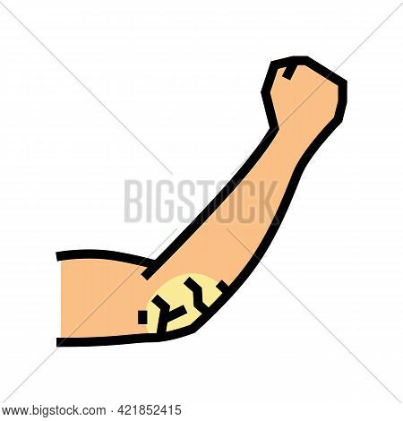 Elbow Dry Skin Color Icon Vector. Elbow Dry Skin Sign. Isolated Symbol Illustration