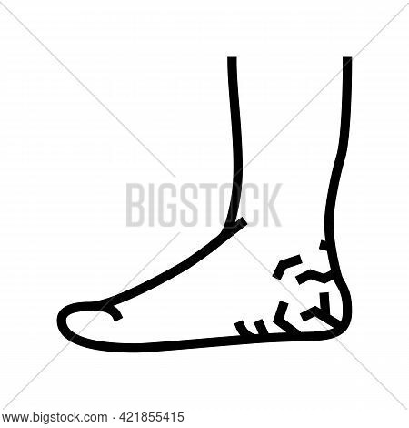 Heels Dry Skin Line Icon Vector. Heels Dry Skin Sign. Isolated Contour Symbol Black Illustration