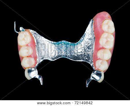 Removable Dental Prosthesis