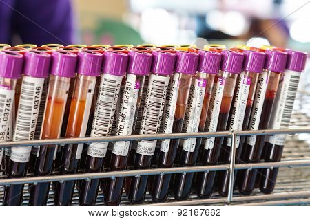 blood sample tubes