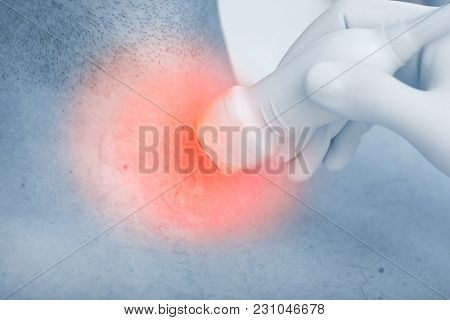 Сoncept Of Ultrasound Diagnosis Of The Disease In The Lesion During A Visit In The Outpatient Clinic