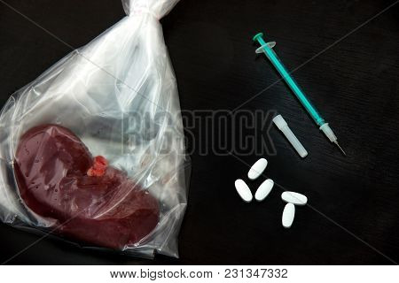 Medication Cure Diabetic Nephropathy. Treatment Of Diabetes Mellitus To Slow, Avoid Renal Failure. T
