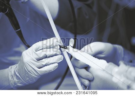Endoscopic Bronchoscopy Procedure To The Patient Performing By Medical Team.