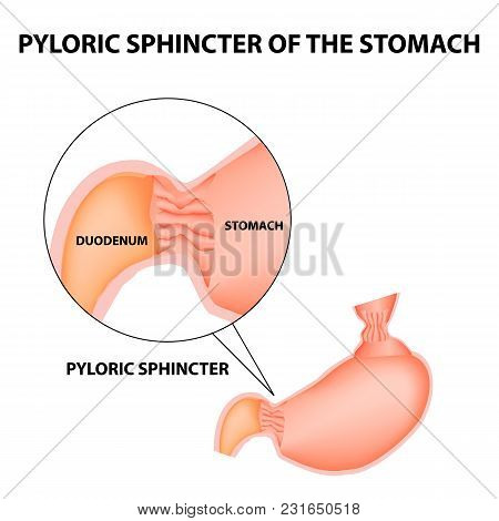 Pyloric Sphincter Of The Stomach Duodenum. Pylorus. Infographics. Vector Image On Isolated Backgroun