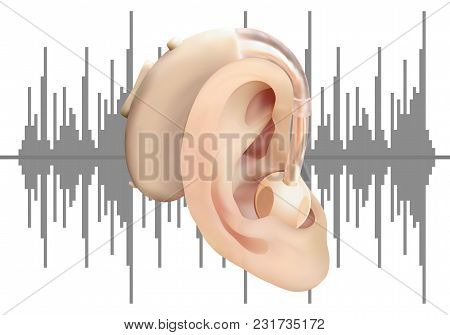 Digital Hearing Aid Behind The Ear, On Background Of Sound Wave Diagram. Treatment And Prosthetics O