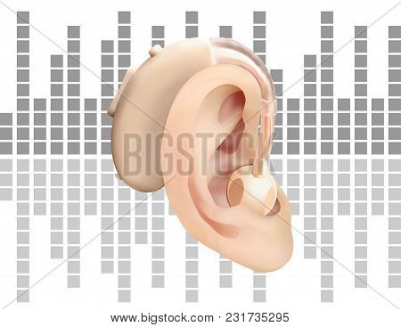 Digital Hearing Aid Behind The Ear, On Background Of Sound Wave Diagram. Treatment And Prosthetics O