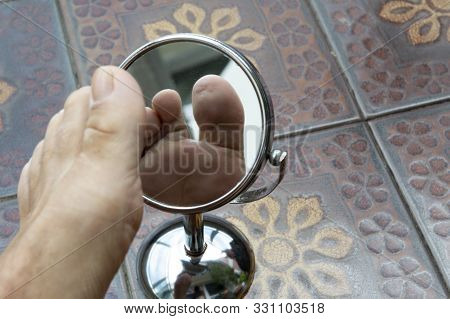 Person Looking At The Sole Of The Foot In A Mirror, To Check If There Is No Diabetic Foot, As Possib