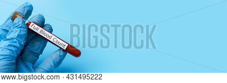 Hand Holding A Test For A Full Blood Test In A Test Tube On A Blue Background. The Concept Of Medici