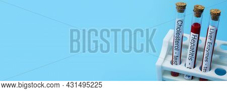 Cholesterol Test Hepatitis Test And Liver Enzyme Test, In Vitro. The Concept Of Medicine And Analysi