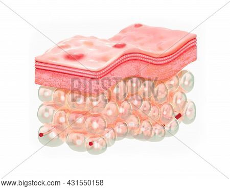 Skin With Acne. 3d Illustration Of The Structure Of The Skin Layers Microstructure.medical And Educa