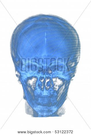 Human Skull Xray