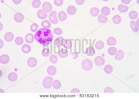 Pmn With Toxic Granule