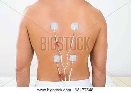 Man With Electrodes On His Back