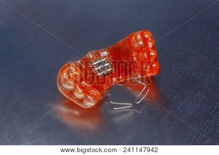 Red Dental Braces Or Retainer For Teeth On Metall Background, Closeup