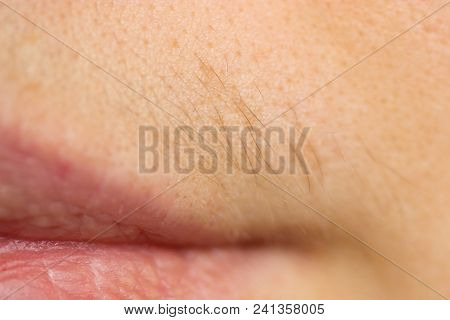 Small Hairs Above Lips