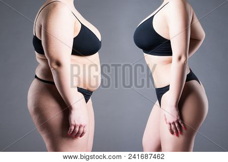Woman's Body Before And After Weight Loss