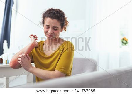 Disgusting Rash. Young Girl Feeling Helpless To Resist The Itchiness Caused By The Rash On Her Elbow