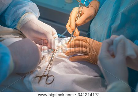 Close-up, A Team Of Pediatric Surgeons Perform Surgery For Ear Lymphadenitis. Oncologists Perform A 