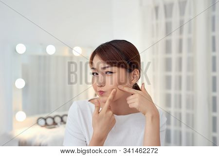 Young Asian Woman Squeeze Her Acne - Imahe