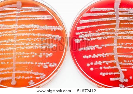 Bacteria Count In Urine Culture.
