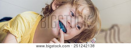 Three-year Old Boy Shows Myofunctional Trainer To Illuminate Mouth Breathing Habit. Helps Equalize T