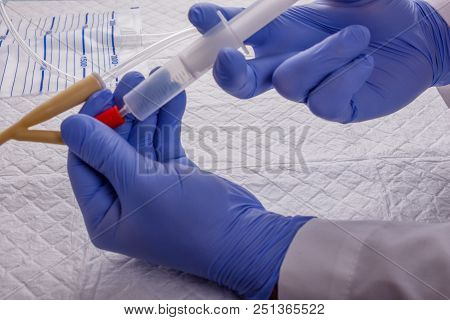 Nurse Inflates Urinary Catheter Bulb With Leg Drainage Bag On Sterile Field