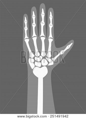 Human Arm Under X-rays Color Vector Illustration, Hand With White Bones And Finger Joints Isolated O