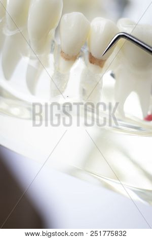 Dentist Cleaning Teeth