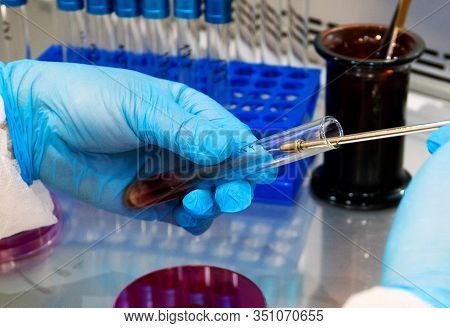 Hand Holds Petri Dish With Bacteria Culture
