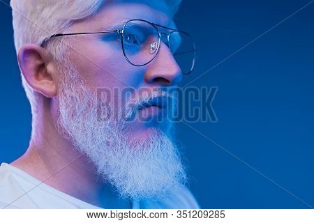 Side View Of Crop Serious Confident Adult Bearded Male With Albinism Wearing Eyeglasses Looking Away