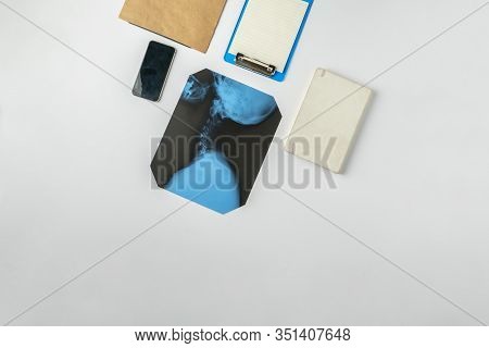 A Flat Lay Medican X-ray Scan Of Bones, Search For Diagnos On The Nurses Table