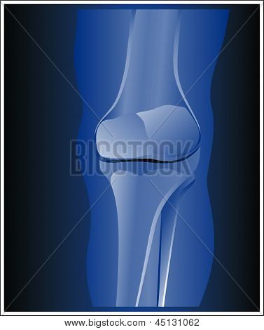 Medical - rayons x
