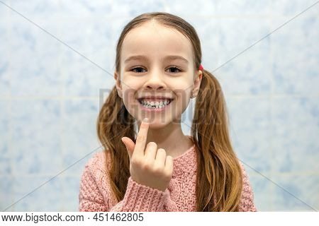 Girl Child Shows The First Molar And Smiles. The First Molar In A Child's Life. Funny Little Girl Po