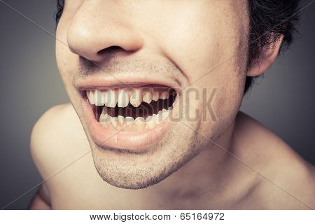 Young Man With Plaque On His Teeth