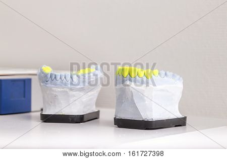 Technical shots of model on a dental prothetic laboratory