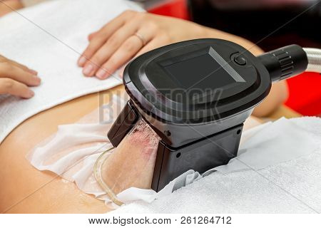 Woman Getting Cryolipolysis Fat Treatment Procedure In Professional Cosmetic Cabinet Or Spa Center