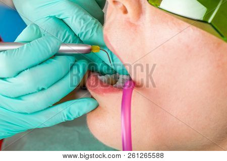 Dentist Using A Professional Dental Laser For Oral Treatment