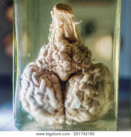 Reserved Animal Brain In Liquid Formaldehyde In Glass Jar In Scientific Veterinary Laboratory, Close
