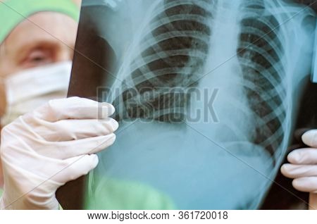 An Elderly Doctor Pulmonologist In Medical Clothes Examines An X-ray Of The Patient's Lungs. Pandemi