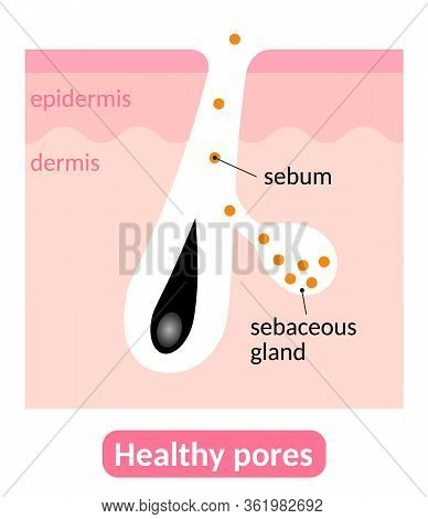 Healthy Pores And Sebum. Sebaceous Glands Produce Right Amount Of Sebum,which Keeps The Skin Great C