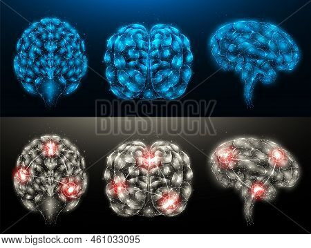 Set Of Polygonal Vector Illustrations Of A Healthy Brain And A Diseased Brain With Foci Of Inflammat