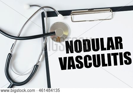 Medical Concept. On A White Surface, A Stethoscope And A Tablet With An Inscription - Nodular Vascul