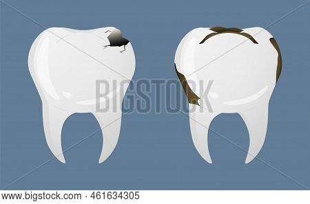 Teeth In Realistic Style. Teeth Decay Icons. Colorful Vector Illustration Isolated On Background.