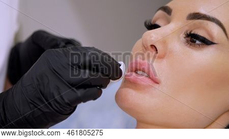 Close-up, Cosmetology Room In The Clinic, The Doctor Wipes Patient Lips With A Sterile Napkin, Befor