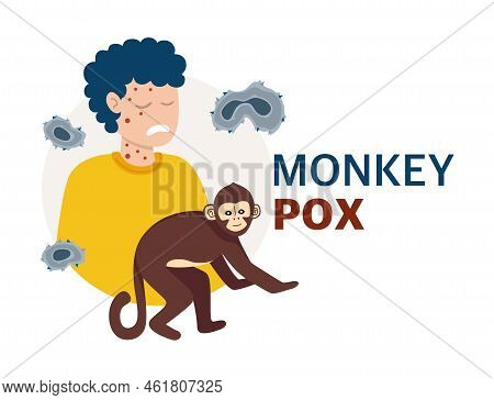 Monkey Pox Virus Poster To Inform About The Pandemic And Spread Of The Disease Images Of Human Virus