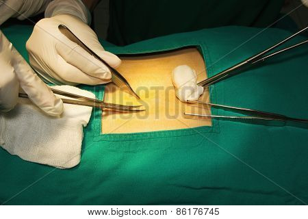 Surgery Operating Room