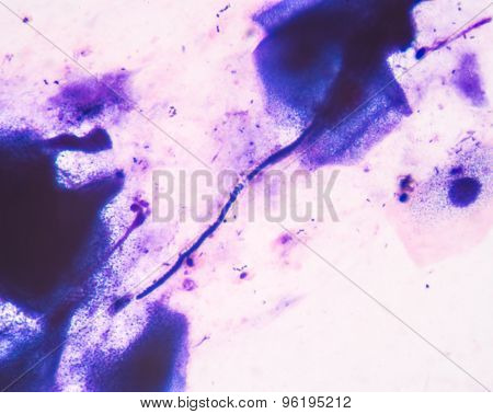 Budding Yeast Cells With Pseudohyphae From Sputum Gram Stain Test, In Laboratory,fine With Microscop