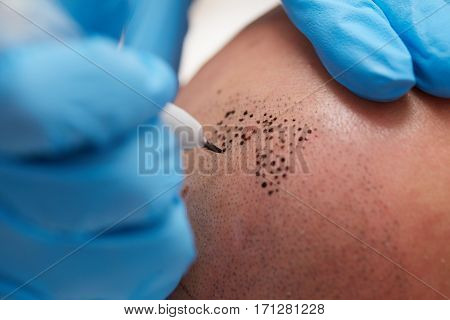 professional tattooist making permanent make up tricopigmentation